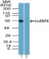 HNRNPK / hnRNP K Antibody (aa1-50)