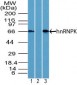 HNRNPK / hnRNP K Antibody (aa200-250)