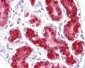 DDX58 / RIG-1 / RIG-I Antibody (aa200-250)