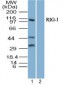 DDX58 / RIG-1 / RIG-I Antibody (aa200-250)