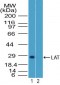 LAT Antibody (aa70-120)