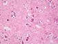 RPS6KA5 / MSK1 Antibody (aa551-600)
