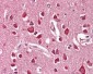UNC5H3 / UNC5C Antibody (Internal)