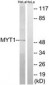 PKMYT1 Antibody (aa49-98)