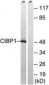 CTBP1 / CTBP Antibody (aa388-437)