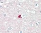 SNAP25 Antibody (aa151-200)