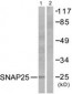 SNAP25 Antibody (aa151-200)