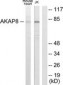 AKAP8 / AKAP95 Antibody (aa331-380)