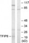 TNFAIP8 / SCC-S2 Antibody (aa31-80)