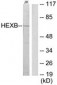 HEXB Antibody (aa481-530)