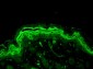 ERK1 + ERK2 Antibody