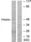 TRIM59 Antibody (aa191-240)