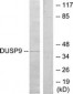 DUSP9 Antibody (aa151-200)