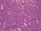HAVCR2 / TIM-3 Antibody (aa176-194)