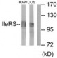 IARS2 Antibody (aa71-120)