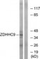 ZDHHC9 Antibody (aa315-364)