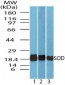 Superoxide Dismutase Antibody