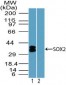 SOX2 Antibody (aa100-150)