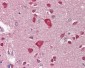 GDF5 / GDF-5 Antibody