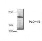 PLCG2 Antibody