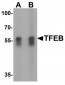 TFEB Antibody (N-Terminus)