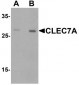 CLEC7A / Dectin 1 Antibody (Internal)