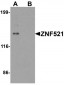 ZNF521 Antibody (N-Terminus)