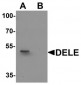 KIAA0141 Antibody (N-Terminus)