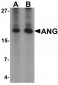 Angiogenin / ANG Antibody (Internal)