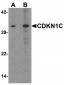 CDKN1C / p57 Kip2 Antibody (N-Terminus)