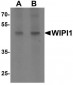 ATG18 / WIPI1 Antibody (C-Terminus)