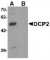 DCP2 Antibody (C-Terminus)