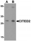 CITED2 Antibody (N-Terminus)