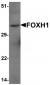 FOXH1 Antibody (N-Terminus)