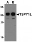 TSPY1 / TSPY Antibody (C-Terminus)