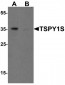 TSPY1 / TSPY Antibody (C-Terminus)