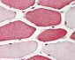APIP Antibody