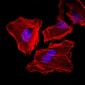 KRT5 / CK5 / Cytokeratin 5 Antibody (clone 2C2)