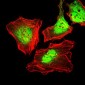 KRT5 / CK5 / Cytokeratin 5 Antibody (clone 2C2)