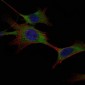HK1 / Hexokinase 1 Antibody (clone 3A10)