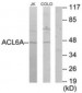 BAF53 / ACTL6A Antibody (aa201-250)