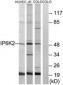 IP6K2 Antibody (aa161-210)