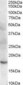 CFL2 / Cofilin 2 Antibody (C-Terminus)