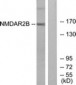 GRIN2B / NMDAR2B / NR2B Antibody (aa1435-1484)