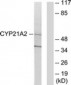 CYP21A2 Antibody (aa151-200)