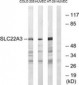 SLC22A3 / OCT3 Antibody (aa275-324)