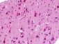 CNR2 / CB2 Antibody (aa191-240)