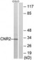 CNR2 / CB2 Antibody (aa191-240)
