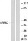 ARR3 / Cone Arrestin Antibody (aa339-388)