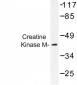 CKM / Creatine Kinase MM Antibody (Tyr14)
